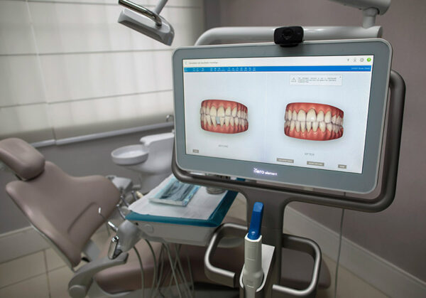 Scanner odontológico da clínica Prime Dente no Méier